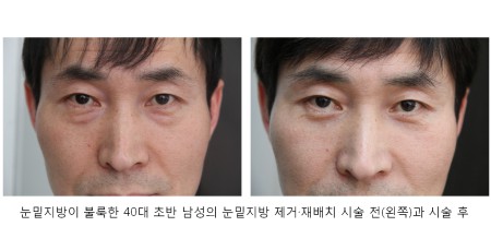 헬스오