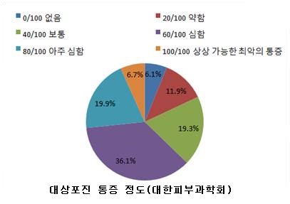 대상포진 통증정도.jpg