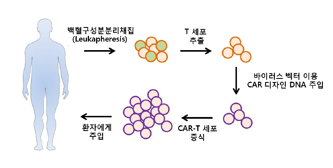 키메라항원수용체-T(CAR-T) 세포치료제의 제조과정(출처 홍성혜 국립암센터 정밀의학연구과 연구원의  ‘CAR-T를 이용한 암 면역치료’ 보고서)