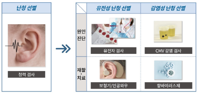 난청의 원인 진단 및 재활·치료 방법