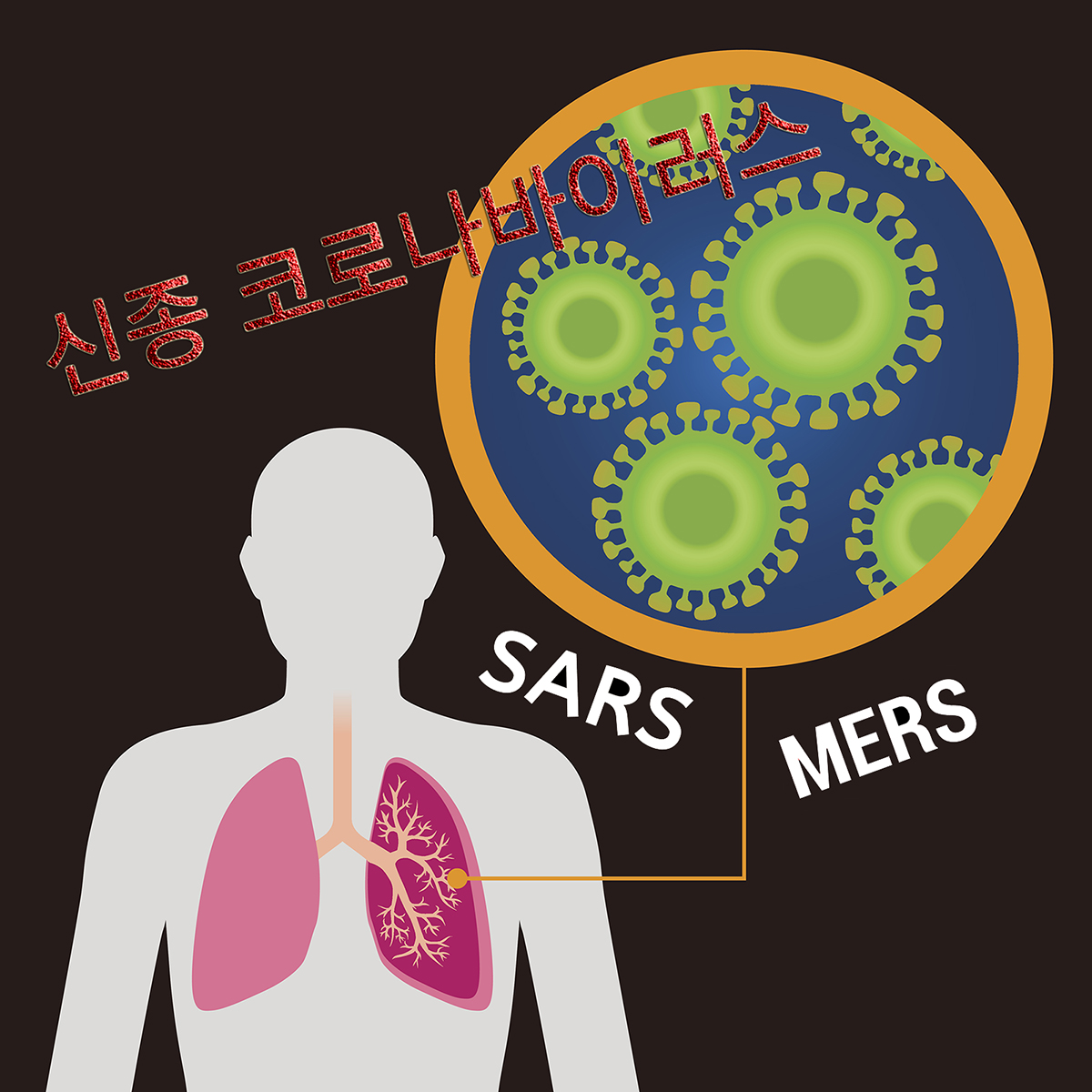 신종 코로나 바이러스의 공기 전파 가능성이 아주 없다고 할 수는 없다. 메르스는 2015년 병원 내 전파로만 81명의 환자가 발생됐다.