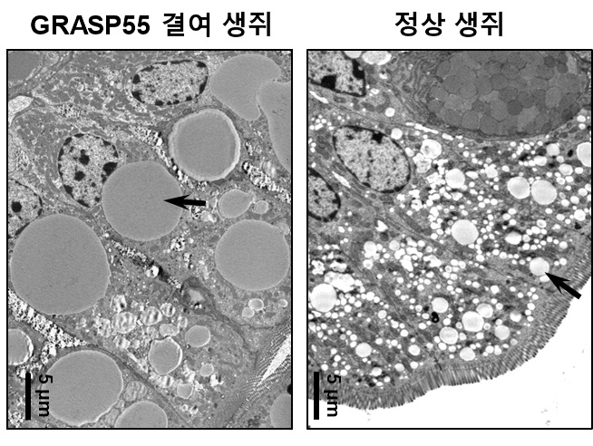 정상 생쥐와 GRASP55 결여 생쥐 소장(small intestine)의 전자 현미경 사진. 외부에서 흡수된 지질 성분이 GRASP55 유전자가 결여된 생쥐의 소장에서는 제대로 분해되지 못하여 커다란 크기의 지방 방울을 형성한다.