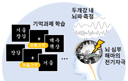 전기 자극을 통한 난치선 뇌전증 환자 기억력 향상 연구에서 해마 전기자극시 단기기억력은 낮아졌으나 연합기억력은 높아졌다.