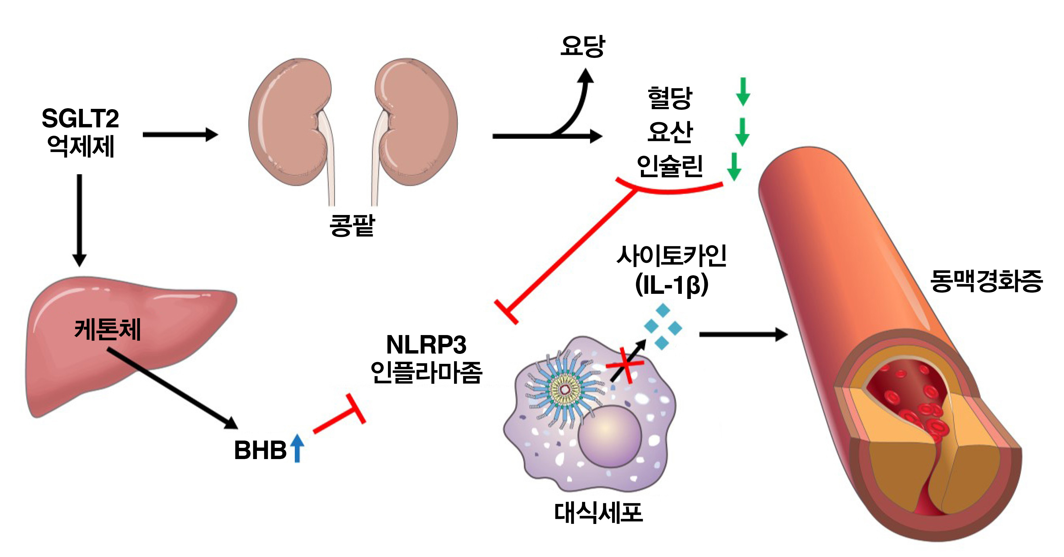 SGLT2 억제제는 기전 설명도. SGLT2 억제제는 간에서 케톤체를 생성해 혈액 내 β-하이드록시부티르산(BHB)을 증가시켜 NLRP3 인플라마좀을 억제한다.