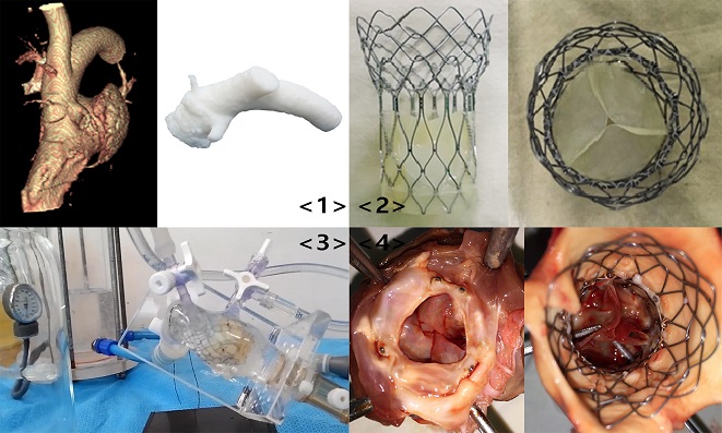 1. 3D프린팅 기술을 활용해 대동맥 근부를 동일하게 제작한다.  2. 형상기억합금으로 제작된 맞춤형 대동맥스텐트와 알파갈이 제거되고 항석회화 처리된 인공판막. 3. 맞춤형 체외모의순환 (in vitro mock circulation) 장치를 제작하고, 생체와 동일한 조건에서 미리 시술 및 모의 순환 테스트해 발생 가능한 합병증들을 제거했다. 4. 새로 개발한 인공판막을 양 9마리의 대동맥 근부에 삽입해, 8개월간 관찰한 결과 안전성과 유효성을 입증했다.