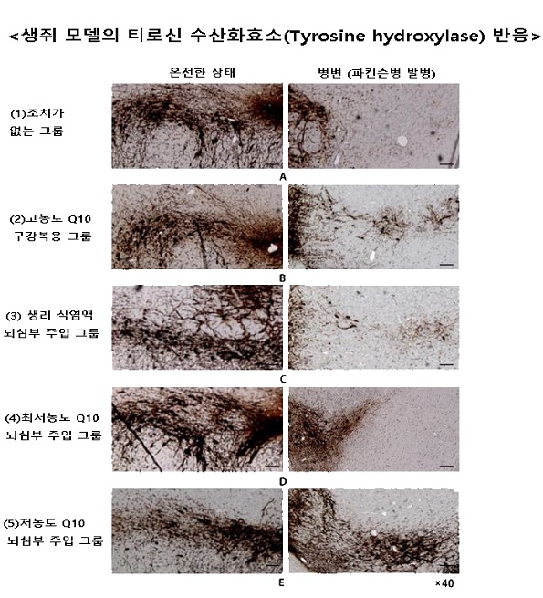 그룹별 온전한 부위(왼쪽)와 병변 부위의 티로신 수산화효소 반응을 나타낸 그림. 티로신 수산화효소가 잘 관찰될수록, 도파민 신경세포 손상이 적음을 의미한다.