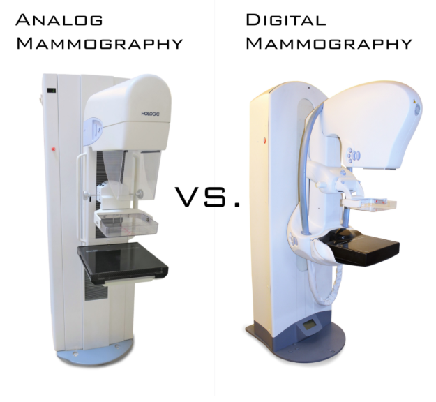 기존 유방촬영검사(2D)와 최근 부상 중인 3D 유방촬영검사 장비 
