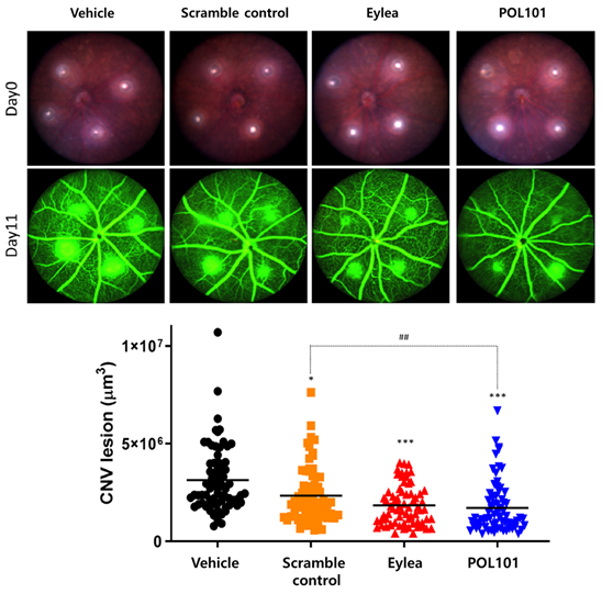 POL101의 맥락막 신생혈관 병변 개선 효과
