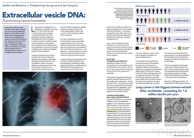 영국의 과학저널 ‘Research Outreach’에 소개된 건국대병원 정밀의학폐암센터 이계영 센터장 연구팀의 연구 논문