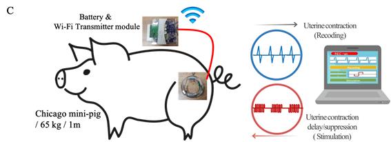 전기자극 동물실험 모형도. 전자약이 자궁수축을 감지하면 연결된 기기에 신호를 보내 알리고 지시에 따라 전기자극으로 자궁수축을 지연시킨다. 전자약에 연결된 송신기를 돼지의 등에 별도로 부착해 자궁 수축 신호를 측정한다. 