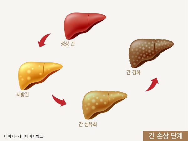 간손상 단계