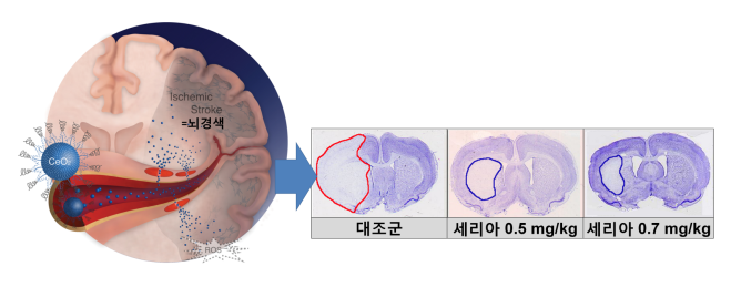 리아 나노입자를 정맥으로 투여.png