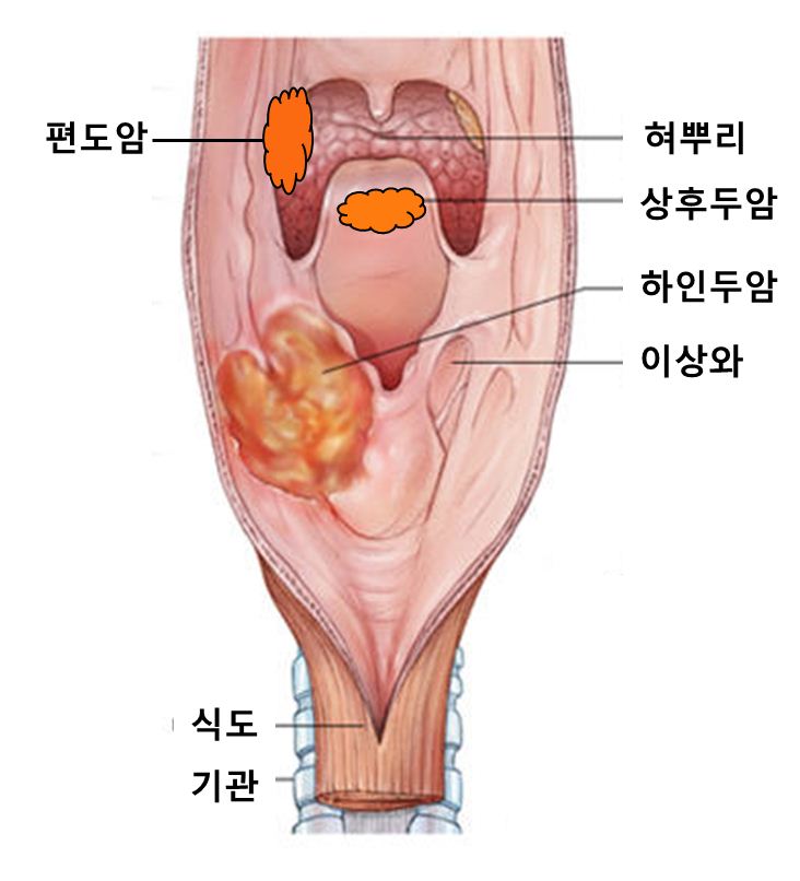 홍보용 2.JPG