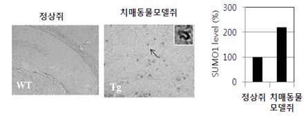 알츠하이머 사진.jpg